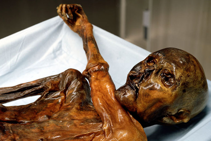 Ötzi